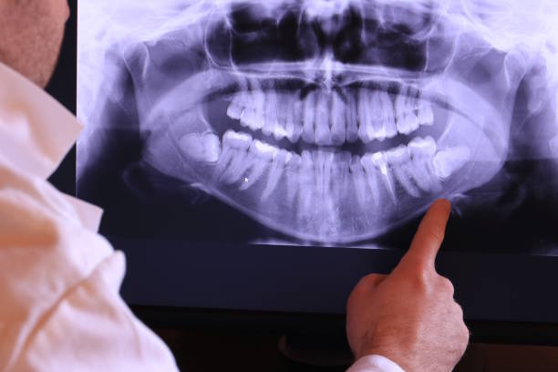 Best Emergency Wisdom Teeth Removal in Fort Stockton, TX