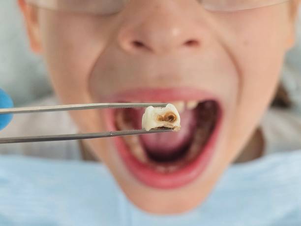 Best Urgent Care for Lost Fillings or Crowns in Fort Stockton, TX